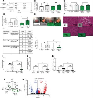 Caspase-11 promotes high-fat diet-induced NAFLD by increasing glycolysis, OXPHOS, and pyroptosis in macrophages